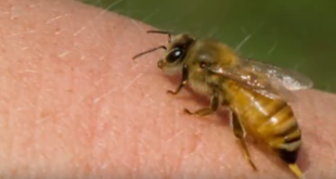 كيف تعالج لسعة النحل ؟
